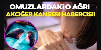 OMUZLARDAKİ O AĞRIYA DİKKAT!