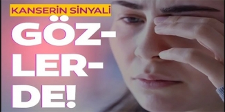 KANSERİN SİNYALİ GÖZLERDE!